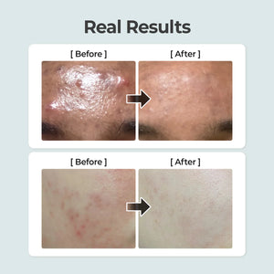 No.1 Pure-Full Calming Herb Toner - Zklidňující tonikum s cica a toulní srdčitou 300ml