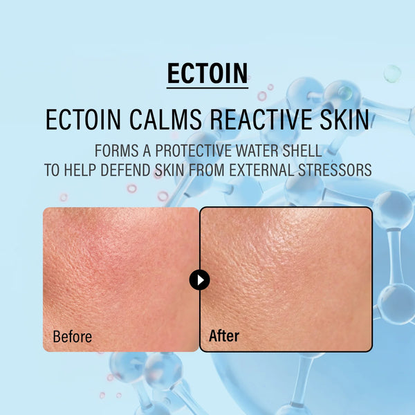 epii - Double Up Cream Ectoin & Panthenol - Zklidňující krém pro posílení kožní bariéry