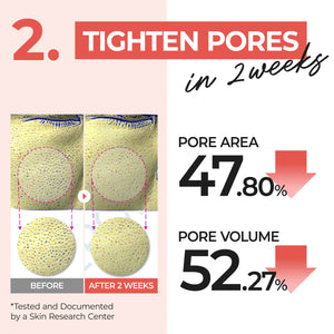 No.4 Pore Zero Peeled Egg Toner Pads - Čisticí a stahující pleťové tampony 70 ks/190ml