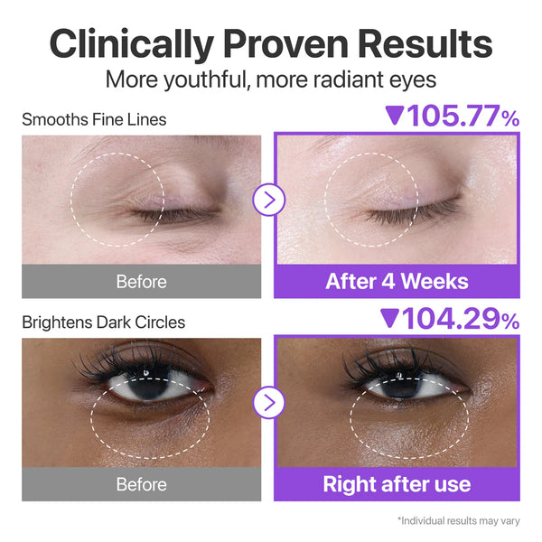 No.9 NAD+ Retinol Volumetox Eye Cream - Intenzivní liftingový oční krém 10ml