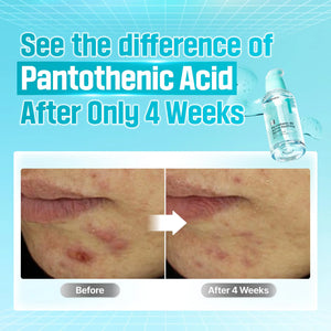 No.1 Pantothenic B5 Active Soothing Serum - Hloubkově hydratační a zklidňující sérum 30ml