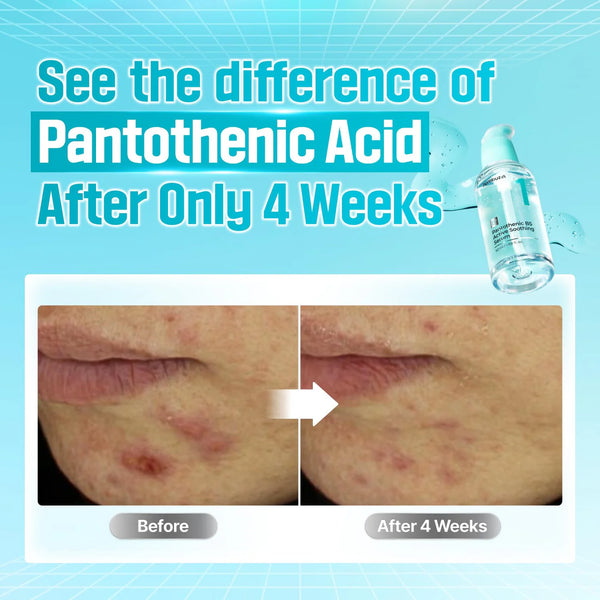 No.1 Pantothenic B5 Active Soothing Serum - Hloubkově hydratační a zklidňující sérum 30ml