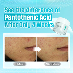 No.1 Pantothenic B5 Active Soothing Cream - Zklidňující a hydratační krém 80ml