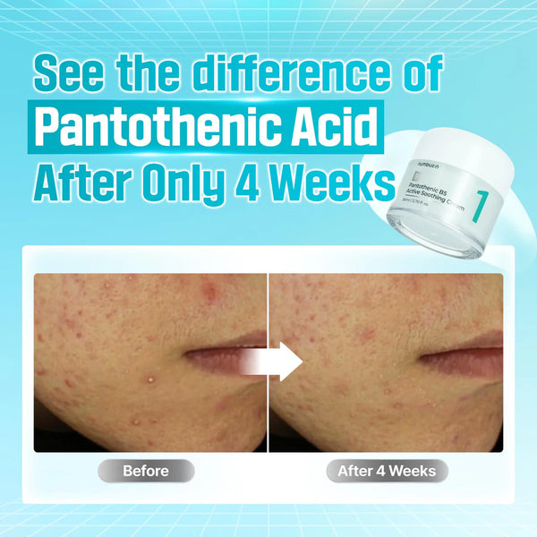 No.1 Pantothenic B5 Active Soothing Cream - Zklidňující a hydratační krém 80ml