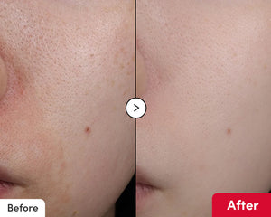 Vitamin illuminating Serum - Rozjasňující sérum proti pigmentovým skvrnám 30ml