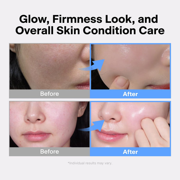 THOME - The Glow Signature - Ultrazvukový kosmetický přístroj pro jasnější, hydratovanější a pevnější pleť