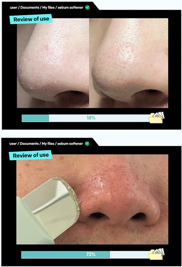 Super Melting Sebum Softener - Přípravek pro rozpuštění černých teček 150ml