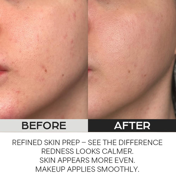 House of Hur - Clearing Skin Prep Essence Pad - Jemné exfoliační polštářky s AHA, BHA a PHA kyselinami pro čistší póry a hladší pleť