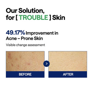 Teatree Trouble Pad - Zklidňující tonizační polštářky s čajovníkem 100ks/150ml