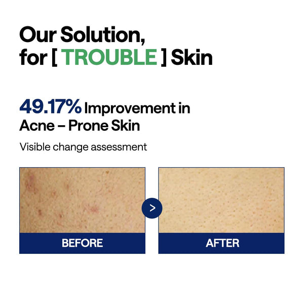 Teatree Trouble Pad - Zklidňující tonizační polštářky s čajovníkem 100ks/150ml