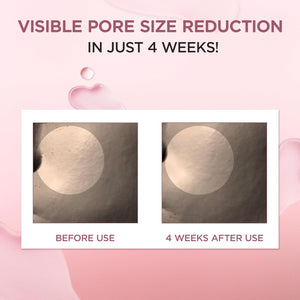 Madagascar Centella Poremizing Fresh Ampoule Jumbo - Ampule minimalizující viditelnost rozšířených pórů 100ml