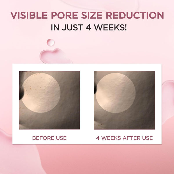 Madagascar Centella Poremizing Fresh Ampoule Jumbo - Ampule minimalizující viditelnost rozšířených pórů 100ml
