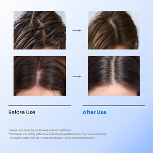 Scalpy Bubble Tonic - Tonikum proti vypadávání vlasů a lupům 100ml