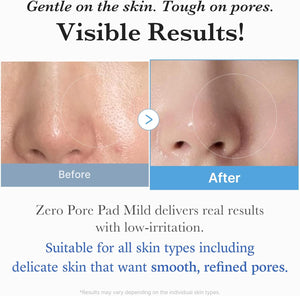 Zero Pore Pad Mild - Jemné tonizující polštářky pro citlivou a podrážděnou pleť 70ks
