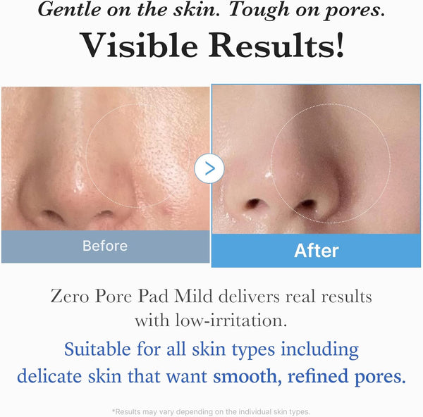 Zero Pore Pad Mild - Jemné tonizující polštářky pro citlivou a podrážděnou pleť 70ks