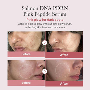 PDRN Pink Peptide Serum – Zpevňující a regenerační sérum proti vráskám 30ml