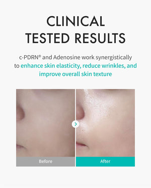 Turnover Mask - Regenerační pleťová maska s c-PDRN® 40ml