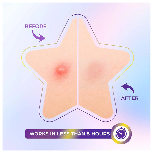 Star Spot Patch - Hvězdičkové hydrokoloidní náplasti 80ks