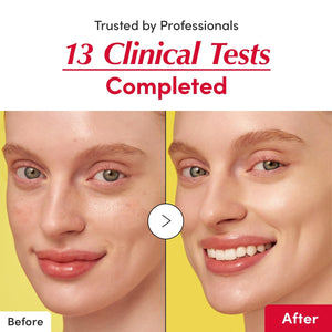 Vitamin illuminating Serum - Rozjasňující sérum proti pigmentovým skvrnám 30ml