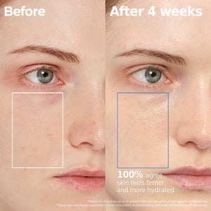 Atobarrier365 hydro Cera-HA Ampoule - Hydratační ampule s ceramidy a kyselinou hyaluronovou 30 ml
