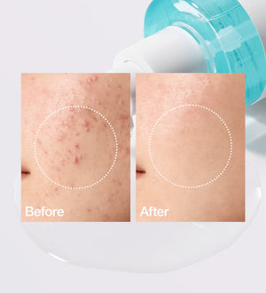 BHA 2% Gentle Exfoliating Toner - Jemné exfoliační tonikum 150ml