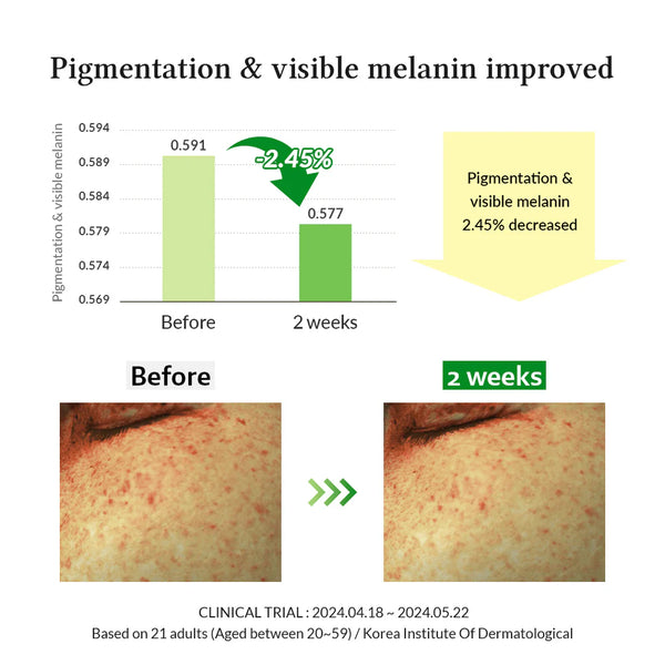 Gentle Vitamin C Serum - Jemné sérum s vitamínem C 30ml