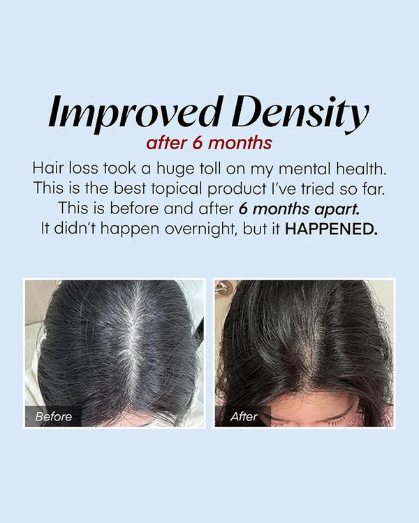 Scalpy Hair Serum - Posilující sérum pro růst vlasů 20ml