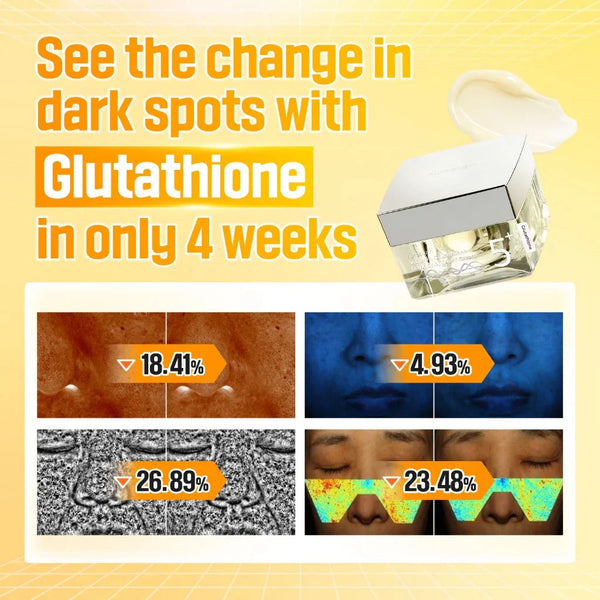 No.5 Vitamin Glutathione Dark Spot Laser Cream - Rozjasňující krém na pigmentové skvrny 50ml