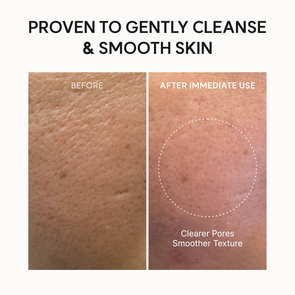 Arencia - Fresh Rosehip Rice Mochi Cleanser - Jemná čisticí pasta pro citlivou a suchou pleť
