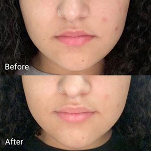 Calendula Peel Off Mask - Čisticí peel-off maska pro hladší pleť a čisté póry 100g