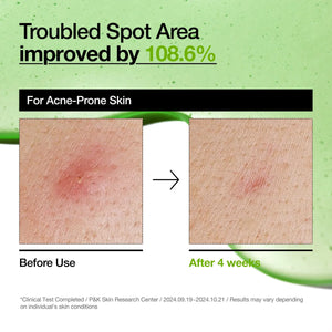 Azelaic Acid 10 Hyaluron Redness Soothing Serum - Zklidňující sérum proti zarudnutí 30ml