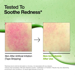 Azelaic Acid 10 Hyaluron Redness Soothing Serum - Zklidňující sérum proti zarudnutí 30ml