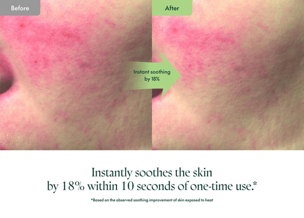 Wonder Releaf Centella Serum - Zklidňující sérum s Centellou, peptidy a allantoinem 60ml