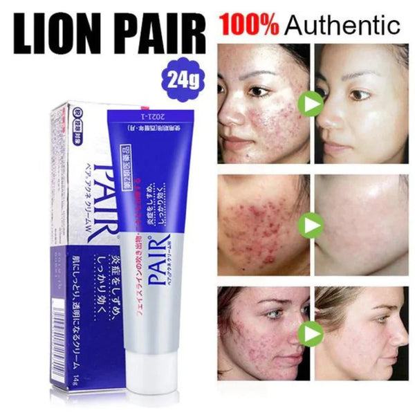 Pair Acne Cream W - Krém proti akné se zklidňujícím a antibakteriálním účinkem 24g