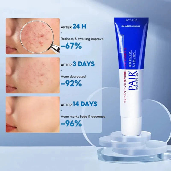 Pair Acne Cream W - Krém proti akné se zklidňujícím a antibakteriálním účinkem 24g