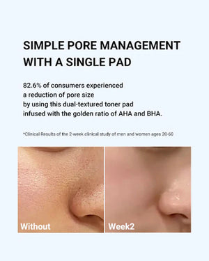 Zero Pore Pads 2.0 - Exfoliační polštářky pro stažení a zúžení pórů 155g